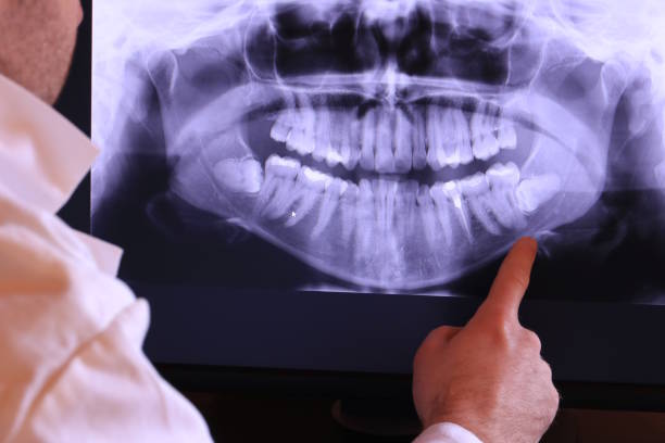 Best Emergency Treatment for Jaw Pain or Injury in Harrisonburg, VA